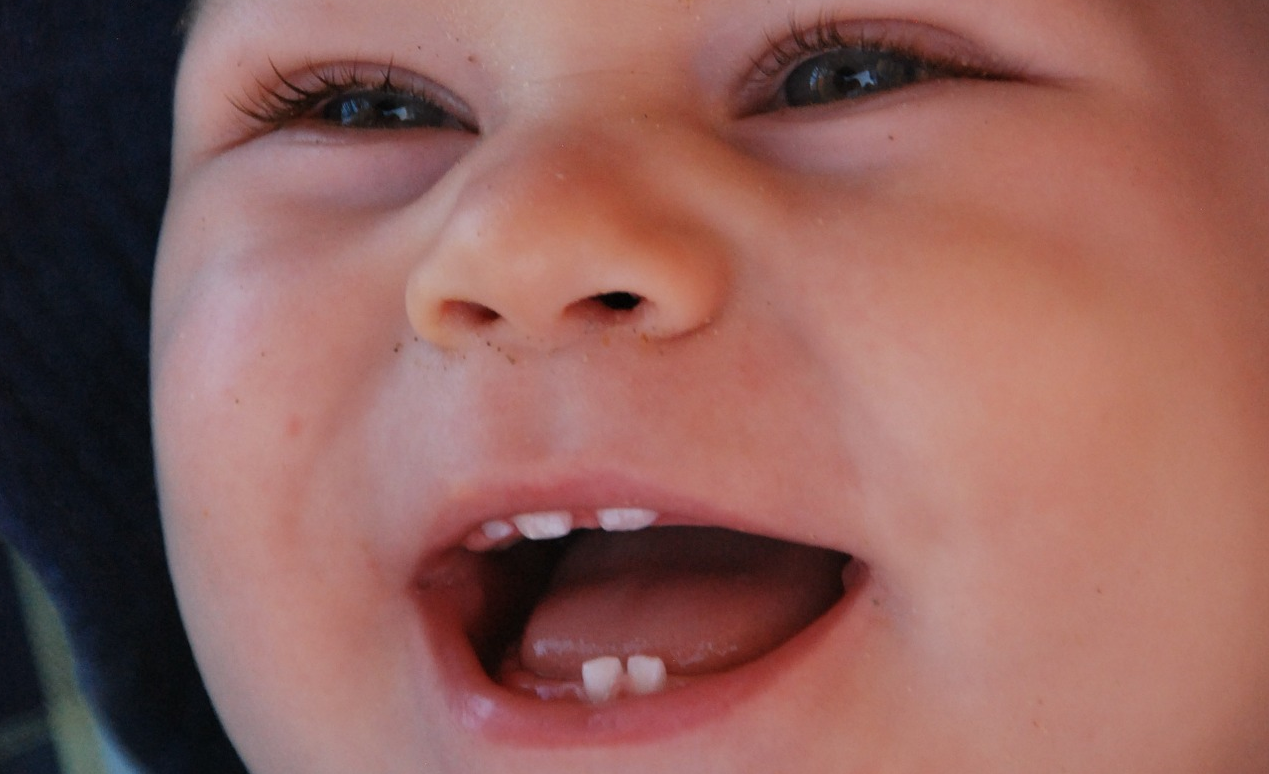 ¿Cómo podemos aliviar las molestias cuando salen los primeros  dientes?