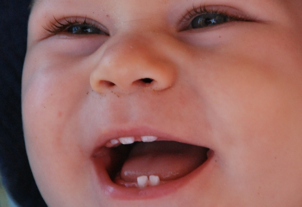 ¿Cómo podemos aliviar las molestias cuando salen los primeros  dientes?