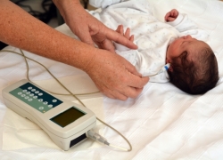 Hipoacusia: controles en el recién nacido